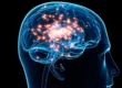 deep brain stimulation