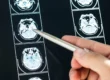 types of brain injuries
