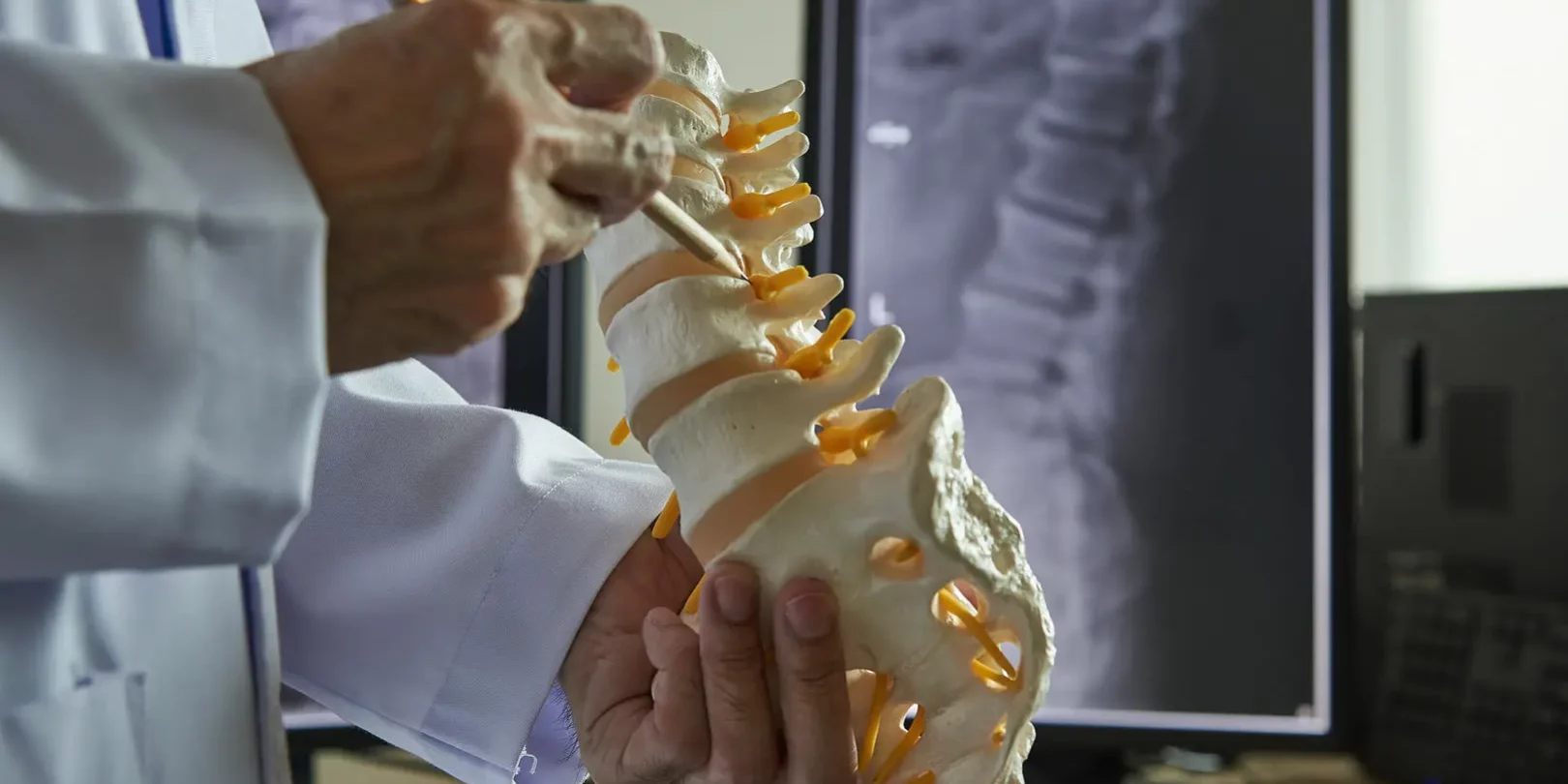 Endoscopic Spine Surgery Endoscopic Spine Surgery